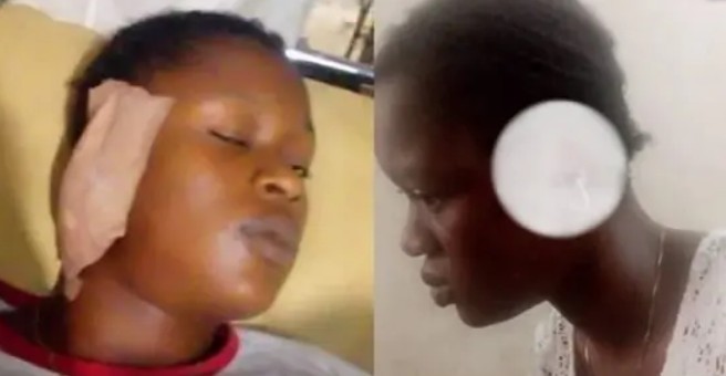 Retired Police Officer Bites Off 18-Years-Old Girl's Ear During Fight In Edo | Daily Report Nigeria