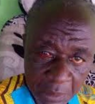 Retired Police Officer Bites Off 18-Years-Old Girl's Ear During Fight In Edo | Daily Report Nigeria