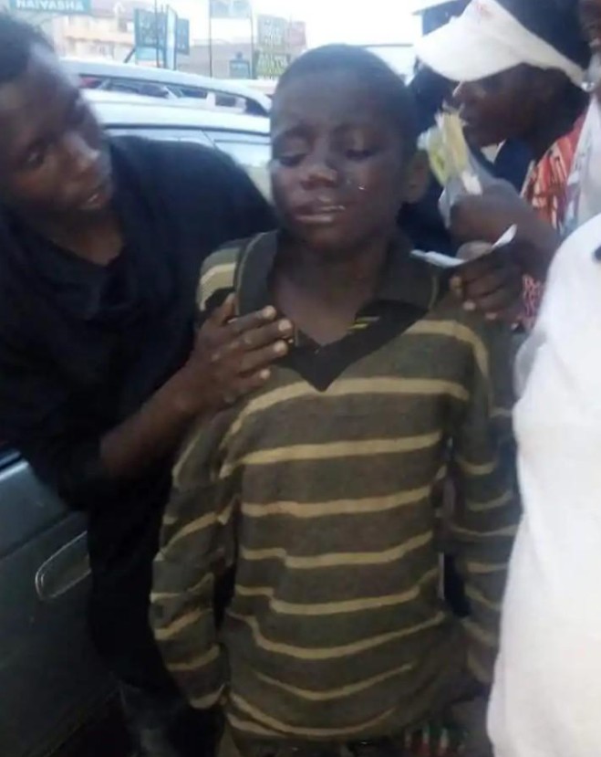 Touching Moment Child Beggar Broke Down In Tears After Seeing Another Lady Placed On Oxygen | Daily Report Nigeria