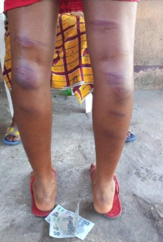 Outrage As Teacher Allegedly Brutalizes Student For Failing To Submit Assignment in Rivers ....(PHOTOS) | Daily Report Nigeria