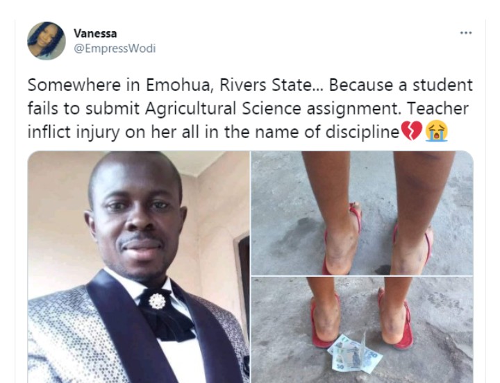 Outrage As Teacher Allegedly Brutalizes Student For Failing To Submit Assignment in Rivers ....(PHOTOS) | Daily Report Nigeria