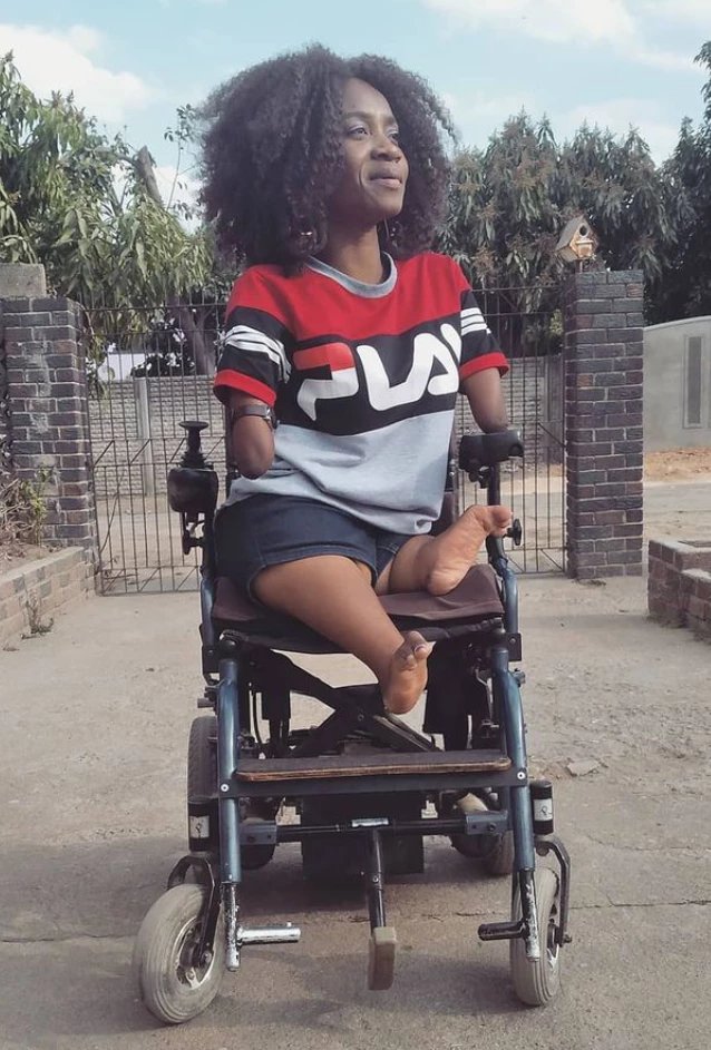 Woman Born Without Limbs Shares Photos Wedding [Photos} | Daily Report Nigeria