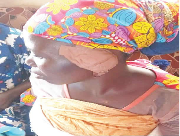 Suspected Yahoo Boy Cuts off Woman's Ear After Futile Attempt to Abduct Her Baby | Daily Report Nigeria