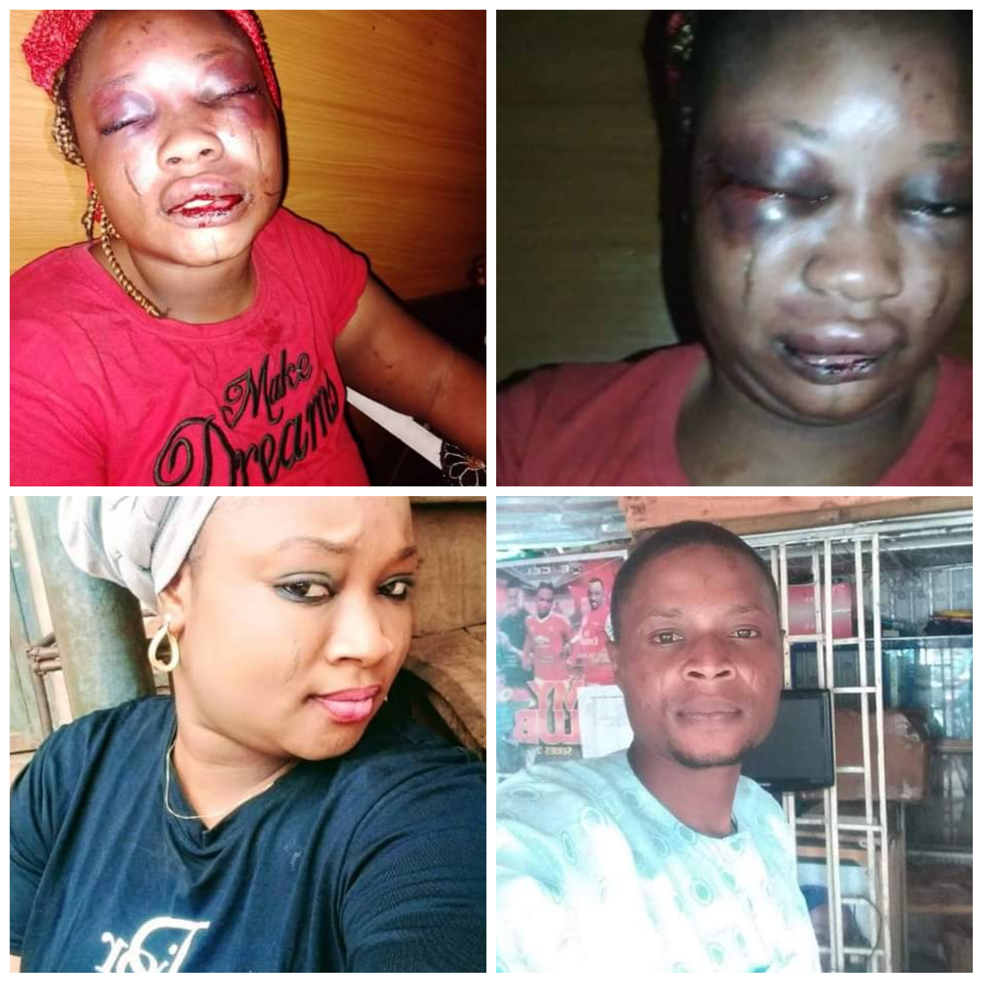 Woman Brutally Assaulted by her Husband over Alleged Infidelity in Oyo | Daily Report Nigeria