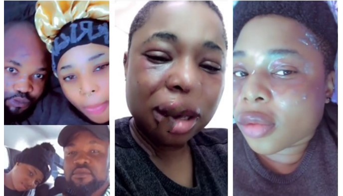 Lady Who Often Show Off Her Boyfriend Shares Photos of Her Bruised Face After Alleged Assault | Daily Report Nigeria