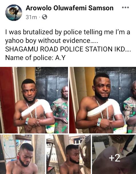 'They Beat Me Up Till My Hand Dislocated'- Nigerian man Accuses police of Being Brutal | Daily Report Nigeria