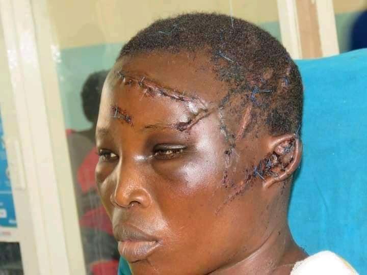 Man Hacks Wife With Machete For Denying Him Sex | Daily Report Nigeria