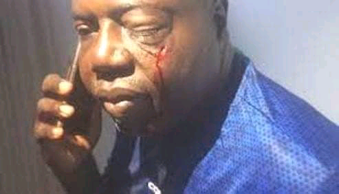 Football Fans Beat up Club Chairman Over N5m Bet Loss | Daily Report Nigeria