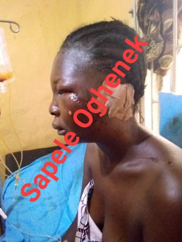 PHOTOS: Man Stabs Wife During Fight in Delta | Daily Report Nigeria