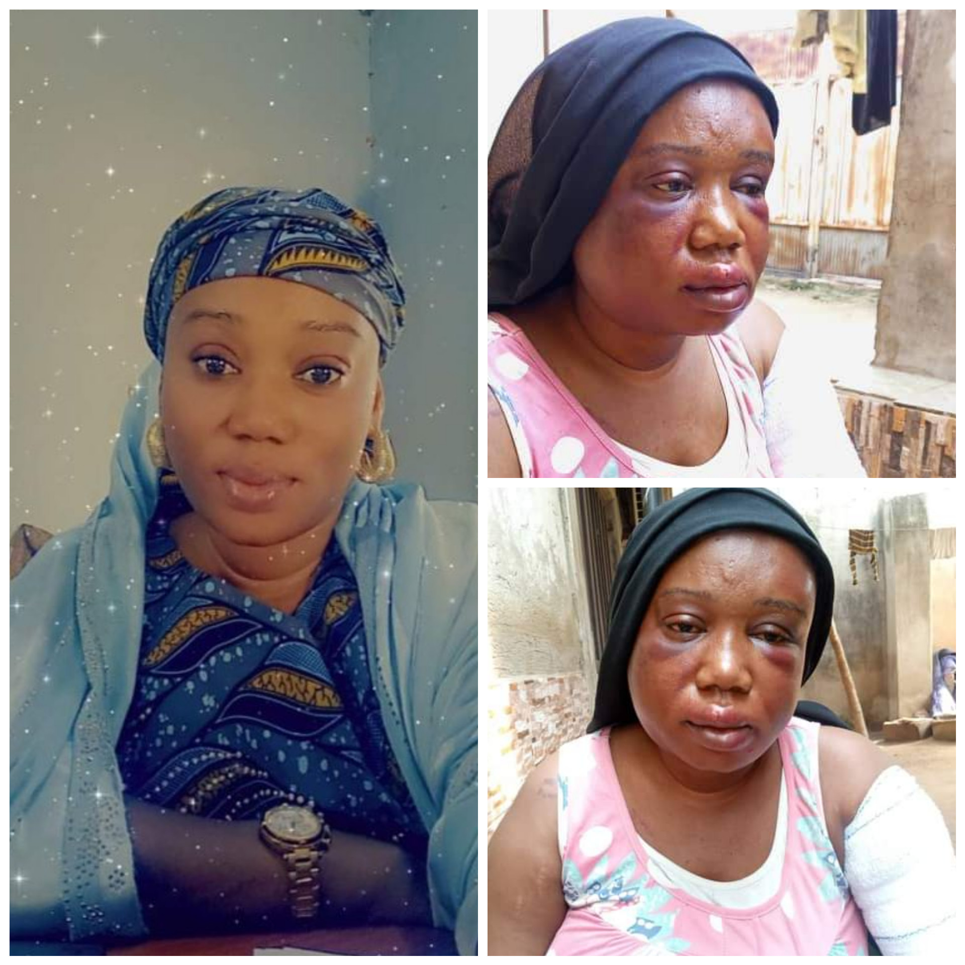 Journalist Battered by Husband in Adamawa | Daily Report Nigeria