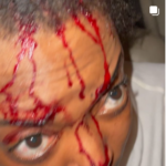 Actress Helen Duru Seriously Injured After Allegedly Being Attacked By EFCC Officials | Daily Report Nigeria