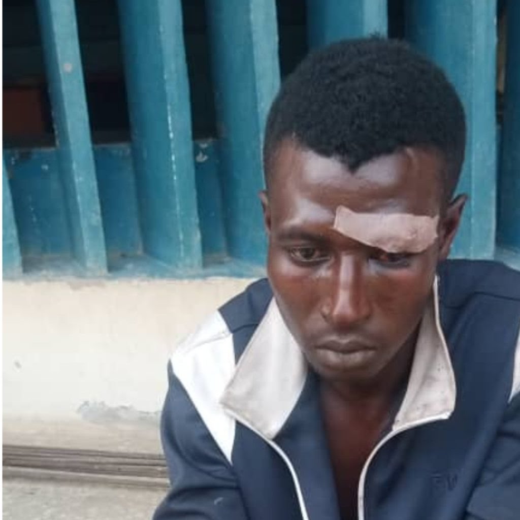 21-Year-Old Man Chops Off Neighbours Wrist Over Girlfriend in Nasarawa | Daily Report Nigeria