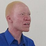 2023: Foundation Calls on 'Albinos' for Political Participation | Daily Report Nigeria