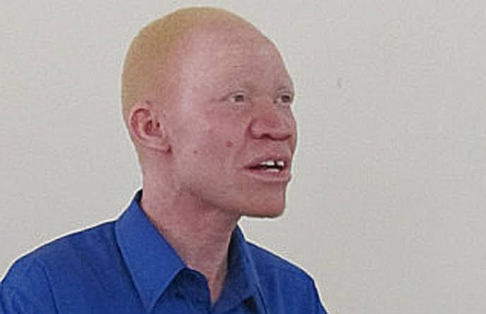 2023: Foundation Calls on 'Albinos' for Political Participation | Daily Report Nigeria