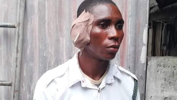 Angry Driver Bites off VIO Officer’s Ear in Delta | Daily Report Nigeria