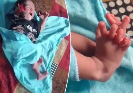 Parents Welcome Baby With 26 Fingers | Daily Report Nigeria