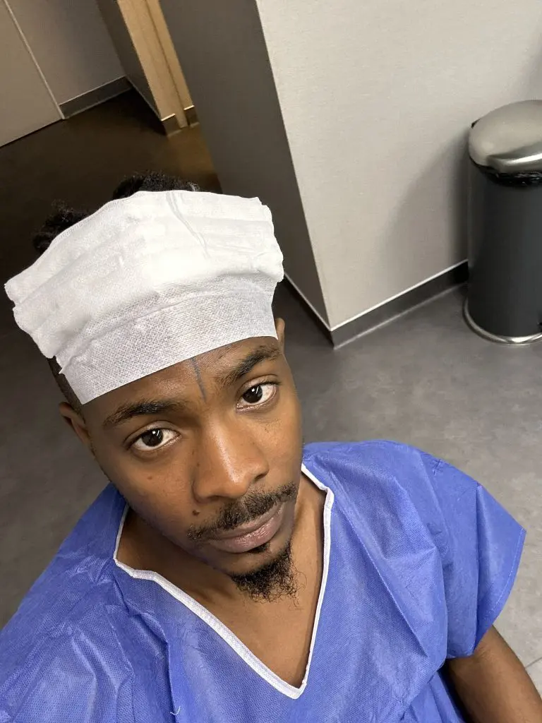 Young Jonn undergoes hair transplant surgery | Daily Report Nigeria