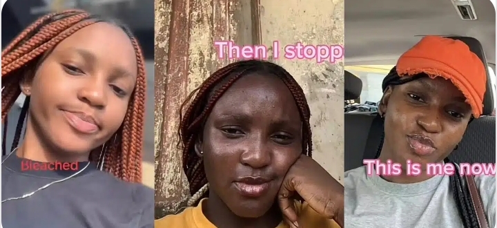 Lady shares her bleaching journey and how she made the tough decision to stop