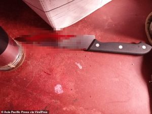 Wife Cut Off Husband Penis For "Moaning Another Woman's Name During S3x" | Daily Report Nigeria