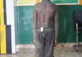 Police Rescue 5-Year-Old Chained, Starved By Father | Daily Report Nigeria