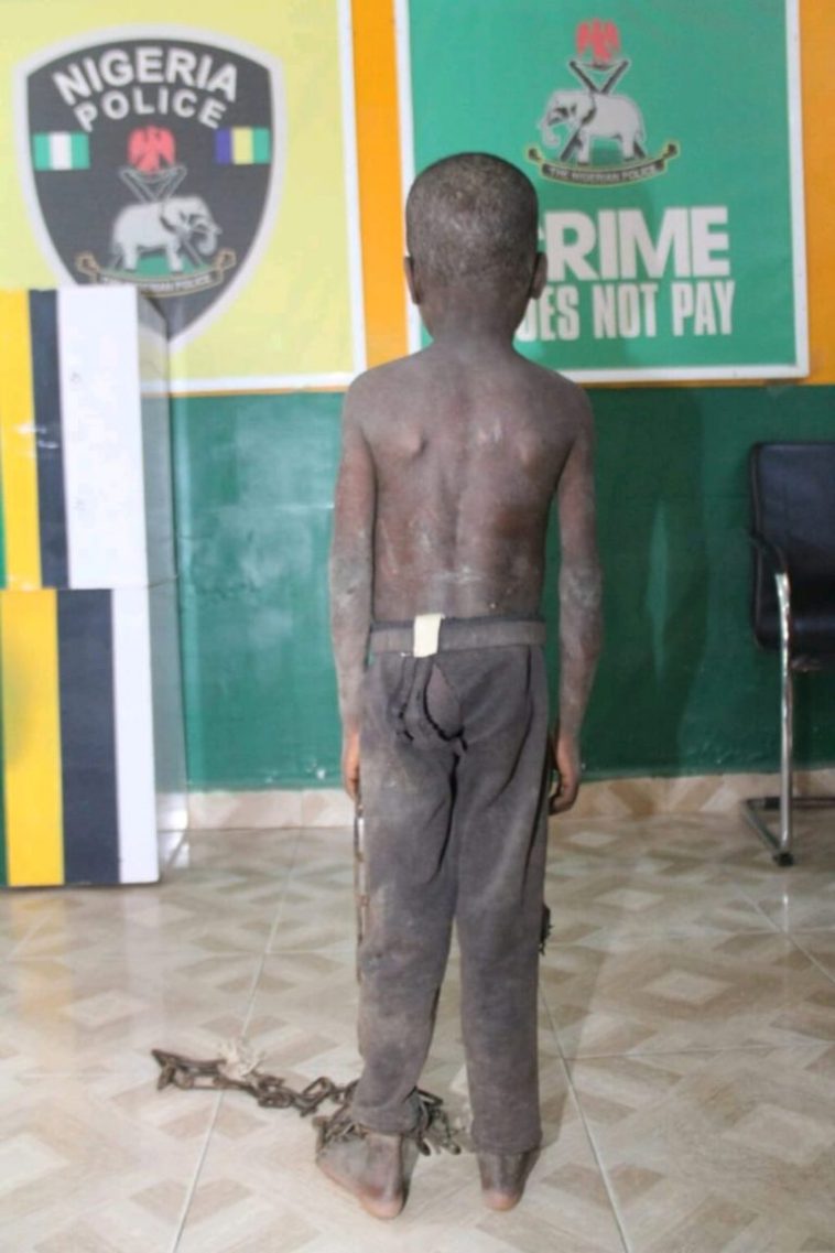 Police Rescue 5-Year-Old Chained, Starved By Father | Daily Report Nigeria