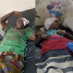 M@d Dog Attack 5-Year-Old Girl, Bites Off Owners Face In Ibadan | Daily Report Nigeria