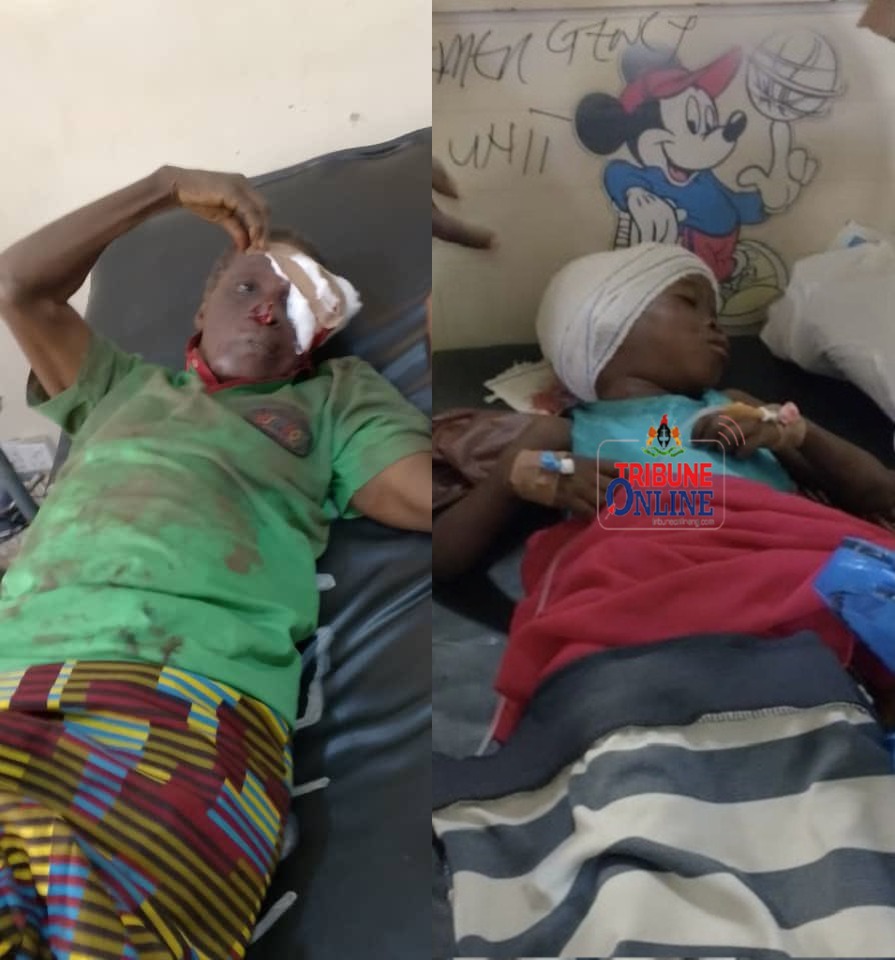 M@d Dog Attack 5-Year-Old Girl, Bites Off Owners Face In Ibadan | Daily Report Nigeria