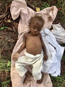 See Amazing Transformation Of Toddler Accused Of Witchcraft In Akwa Ibom [PHOTOS] | Daily Report Nigeria