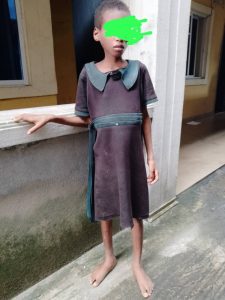 NSCDC Rescues 12-year-old Girl Locked Up, St@rved And T0rtured Over Witchcraft Allegations | Daily Report Nigeria