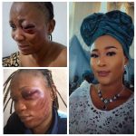 'Ive Lost An Eye' - Woman In Abusive Marriage Cries Out | Daily Report Nigeria