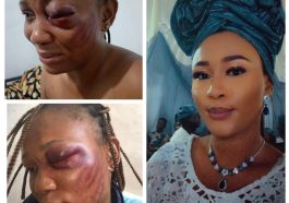 'Ive Lost An Eye' - Woman In Abusive Marriage Cries Out | Daily Report Nigeria