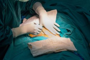 FG Offers free Caesarean Sections For Women 