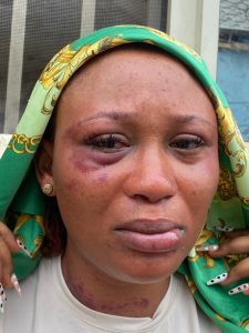 'Ive Lost An Eye' - Woman In Abusive Marriage Cries Out | Daily Report Nigeria