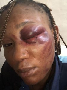 'Ive Lost An Eye' - Woman In Abusive Marriage Cries Out | Daily Report Nigeria