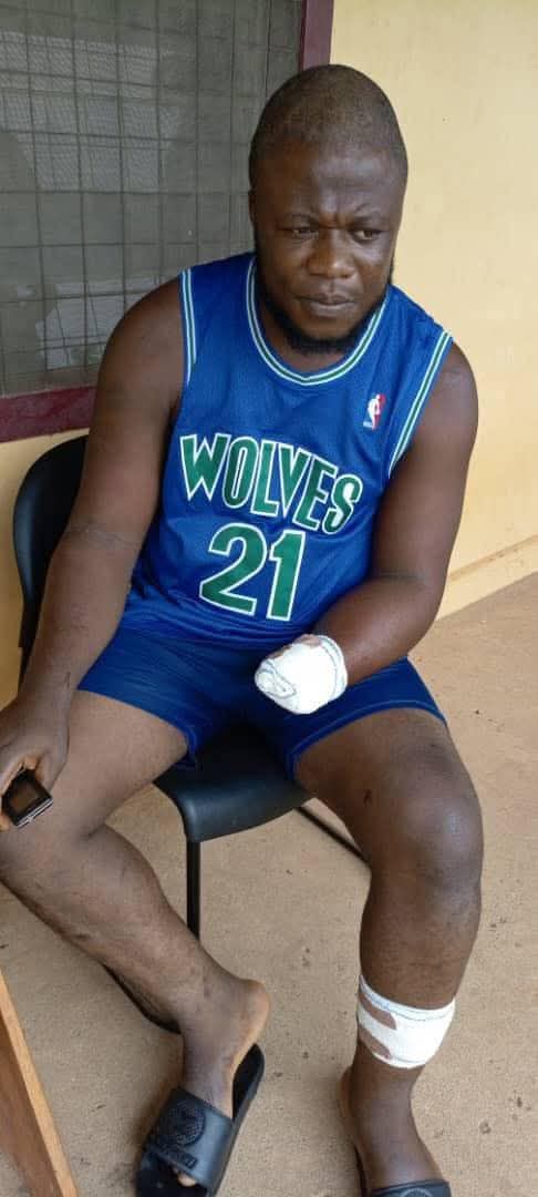 FLASH: Gunmen Chop Off Victims’ Hands In Kogi