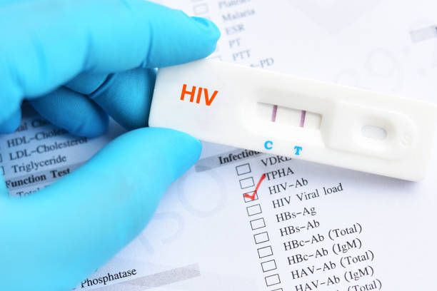 160,000 Lagos Residents Currently Living with HIV — LASCA